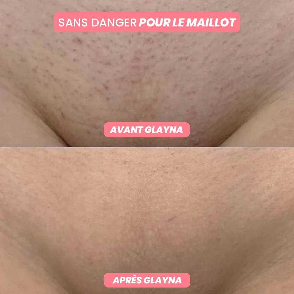 GlaynaOne - Rasoir Électrique Intime