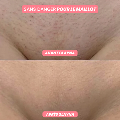 GlaynaOne - Rasoir Électrique Intime