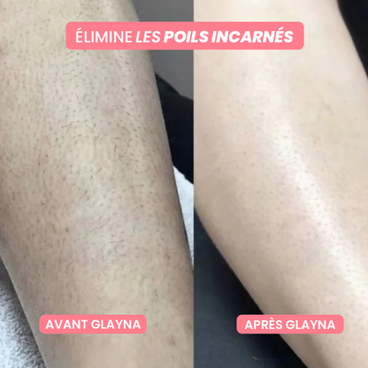 GlaynaOne - Rasoir Électrique Intime