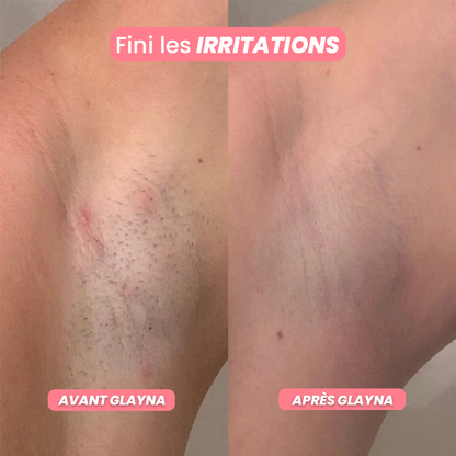 GlaynaOne - Rasoir Électrique Intime