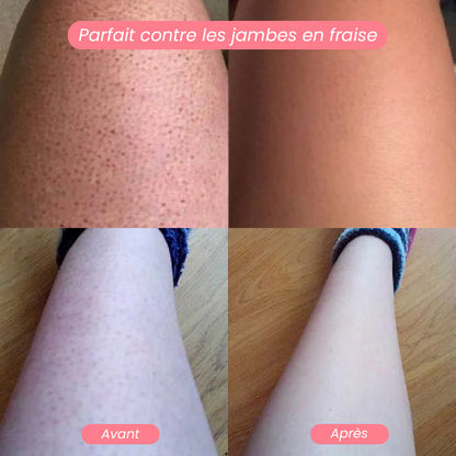 Gomme Dépilatoire
