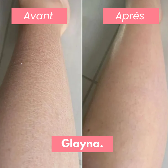 Gant Exfoliant Anti-Poils Incarnés