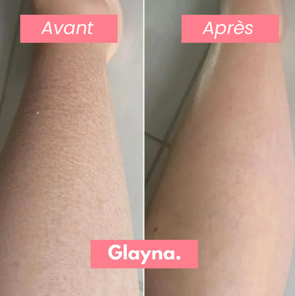 Gant Exfoliant Anti-Poils Incarnés